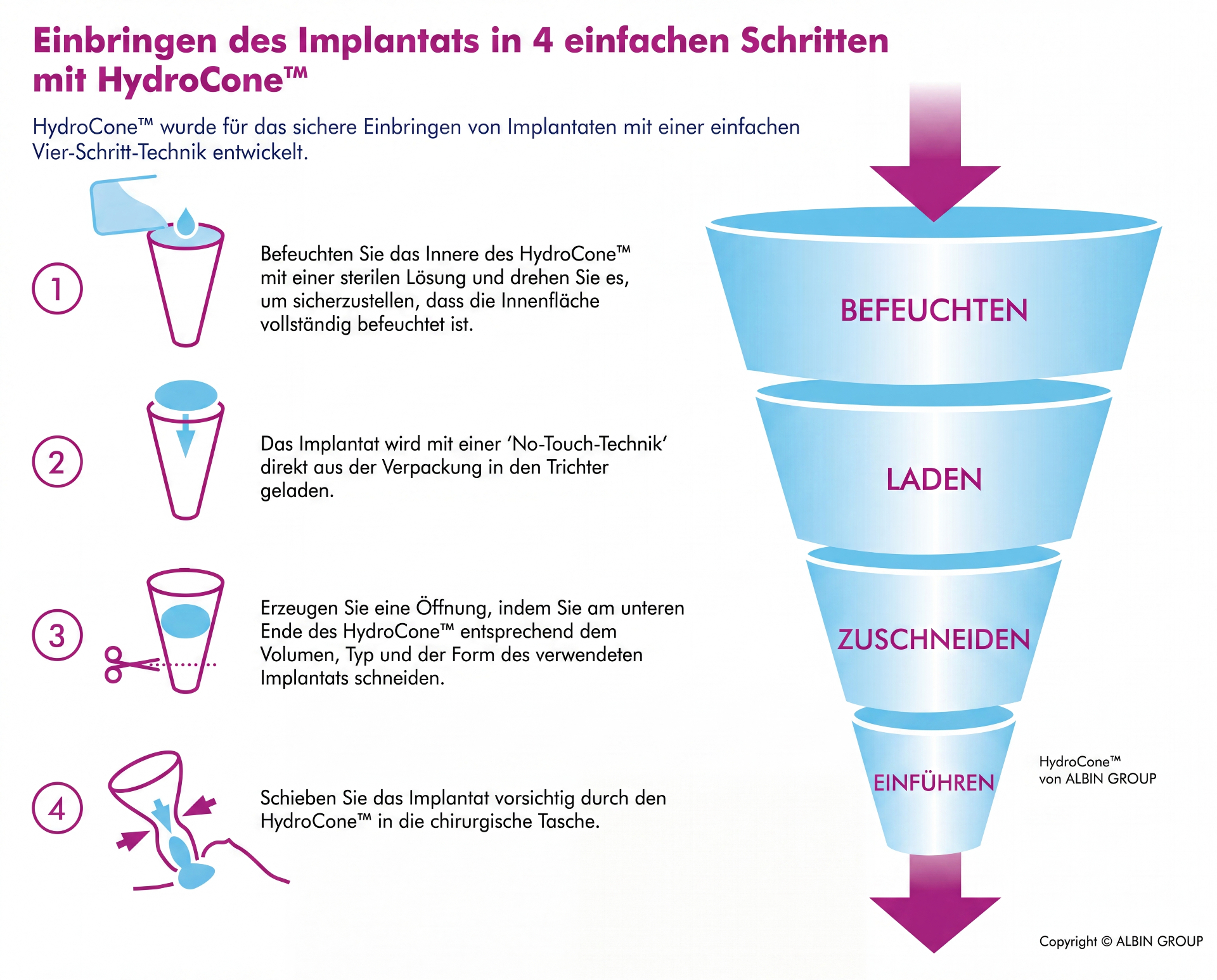 HydroCone – Einbringen des Implantats in 4 einfachen Schritten