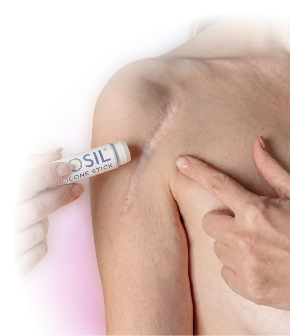 Biodermis Epi-Derm Silikon-Narbentherapie