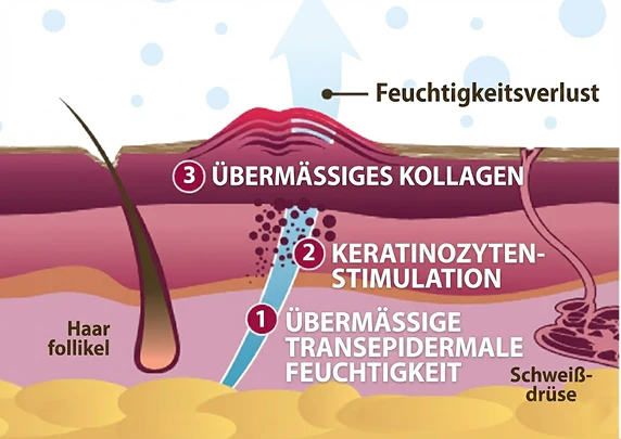 Feuchtigkeitsbarriere