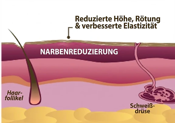 Sichtbare Verbesserung